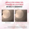 Skin1004 Ampolla De Centella Madagascar Reductora De Poros