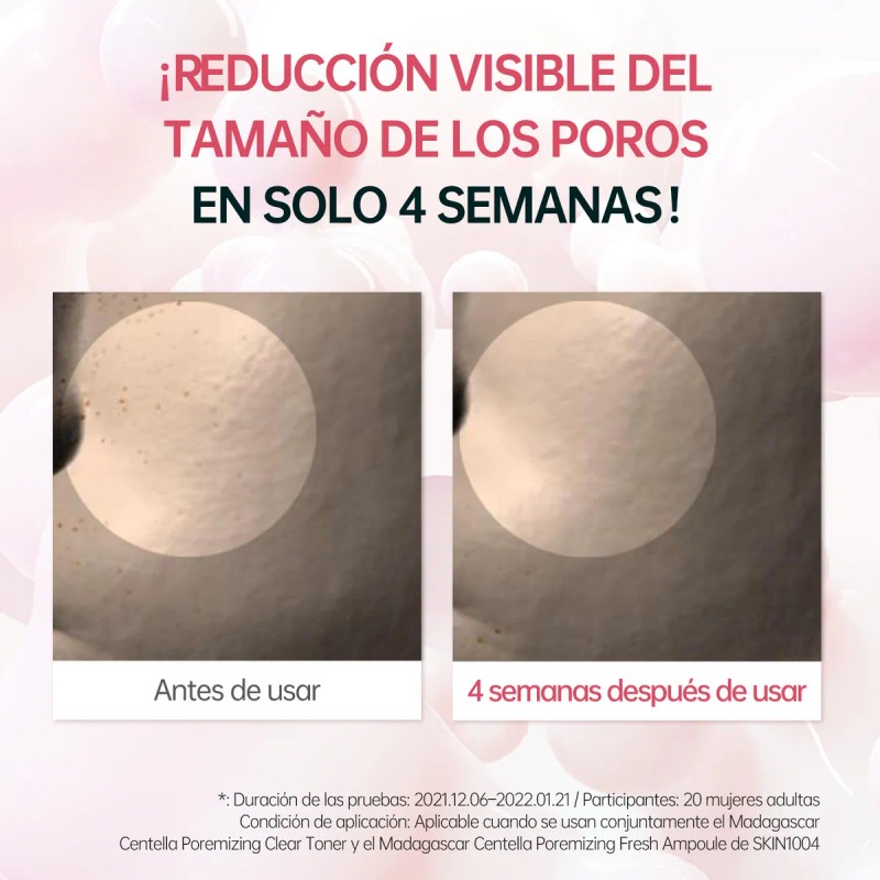 Skin1004 Ampolla De Centella Madagascar Reductora De Poros