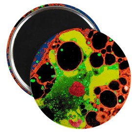 CafePress Herpes Simplex Virus Infection, TEM 2 2.25" Magnet (100 Pack)