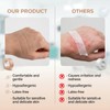 8 Rolls Nose Tape for Rhinoplasty, 0.5 in x 10