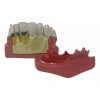 Den Med Modelo Dental Gingivitis