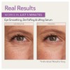Skin Doctors Instant Eye Lift 10mL