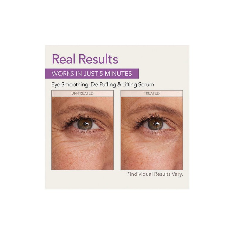 Skin Doctors Instant Eye Lift 10mL