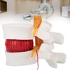 1:1.5 Human Herniated Disc Model Spine Anatomical Medical Study Demonstration