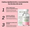 Loción Seca Para Acné, Weud Ácido Salicílico Azufre 29ml