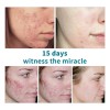Mz . Facial Reafirmante Hidratante Activo Antiarrugas Fade