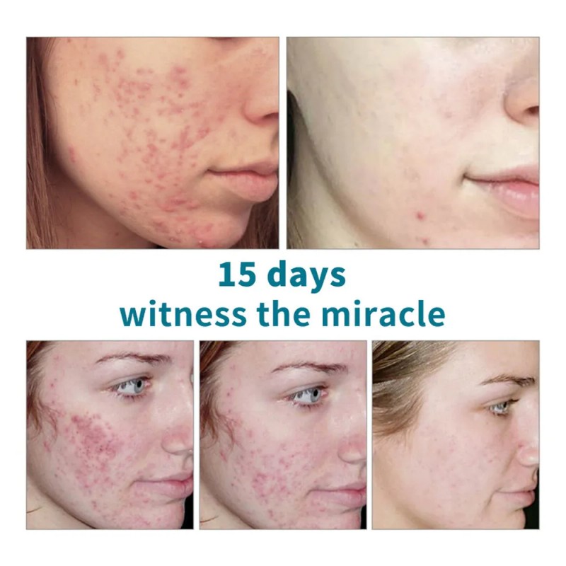 Mz . Facial Reafirmante Hidratante Activo Antiarrugas Fade