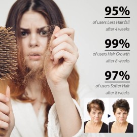 Ampolletas Fortalecedoras De Cabello Anticada Caja 14pcs                                                                                              