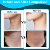 Face Massager Against Wrinkles, 7-in-1 Double Chin Remover, Massager Face