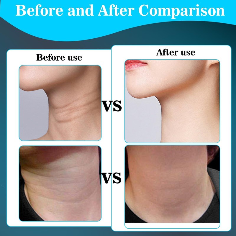 Face Massager Against Wrinkles, 7-in-1 Double Chin Remover, Massager Face