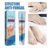 Tt/ Crema Fungicida Para Hongos En Uñas Y Piel De