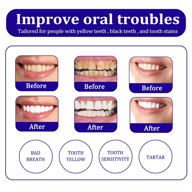 Colour Corrector Serum Purple Toothpaste White Teeth Whitening Whitening Toothpaste