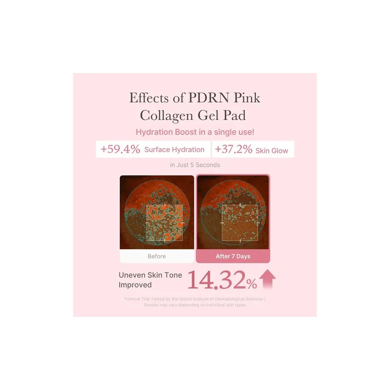 Pdrn Pink Collagen Toning Gel Toner Pads - 70pads