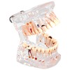 Standard Dental Model for Dentistry Students, Standard Study Teaching Dental