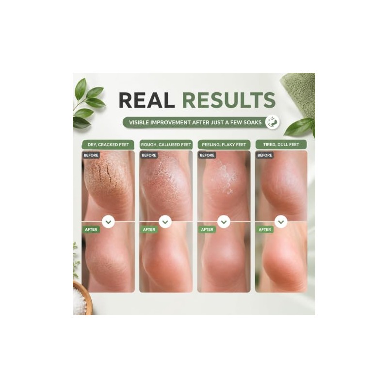 Foot Soak with Tea Tree Oil & Peppermint Oil &