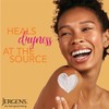 Jergens Ultra Healing Dry Skin Moisturizer; Crema Corporal; 2 Onzas;