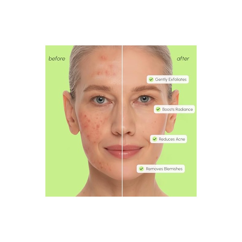 MAREE Exfoliating Toner with 2% Salicylic Acid (AHA BHA) -