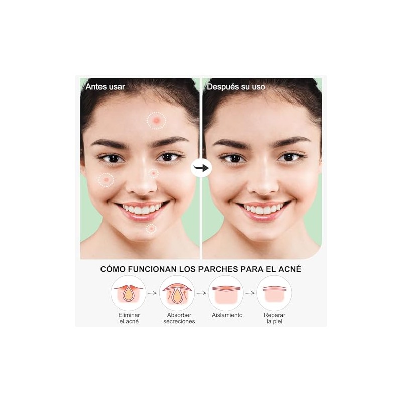 Pimple Patches 720 Parches, Parches para Acne Hidrocoloides, 2 Tamaos