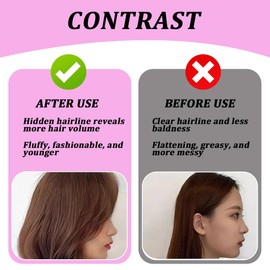 Root Lifting Hair Clip, Pack of 2 Voluminous Hair Clips, Volume Hair Clips for Fluffy Bangs, Volume Clip for Hairline (Purple)