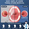 Tonsil Stone Remover with Camera - Upgraded Visual Tonsil Stone