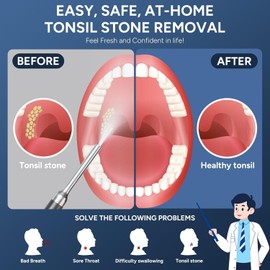 Tonsil Stone Remover with Camera - Upgraded Visual Tonsil Stone Removal Kit