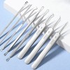 8-Piece Blackhead and Whitehead Remover Extraction Tool Set Acne Extraction Tool 50ea
