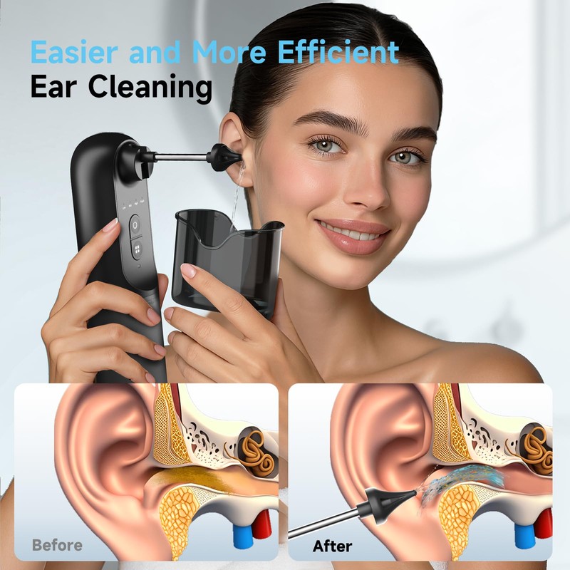 Electric Ear Wax Removal Kit - Ear Cleaner with Water
