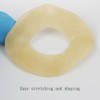 20 PCS Ostomy Barrier Rings No Leaking Barrier Extenders for