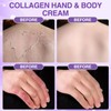 Hand Cream for Dry Skin Relieves and Repairs Extremely Dry