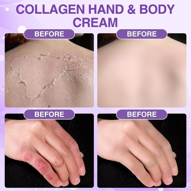 Hand Cream for Dry Skin Relieves and Repairs Extremely Dry