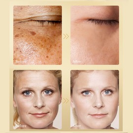 24K Gold Face Serum with Vitamin E and Hyaluronic Acid - Deep Moisturizing, Pure Gold Serum Targeting Signs of Aging, Suitable for a Wide Range of Skin Types - 30ml