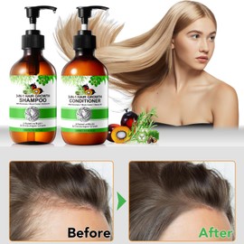 3-in-1 Shampoo and Conditioner Set with Biotin Rosemary, Black Castor and Batana Oil, 2 x 10.56 fl oz Shampoo and Conditioner to Strengthen and Restore Brittle Hair (#3)