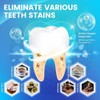 Tiras Blanqueadoras Dientes Sensibles Piezas Kit Completo Fácil Usar Resultados