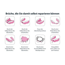 CLICADENT Reparatur set für zerbrochene Gebisse:patentiertes, von einem Zahnarzt entwickeltes Verfahren für gebrochenen Zahnersatz