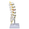 Science Resource S08530 Medical Grade, Articulated Lumbar Spinal Column |