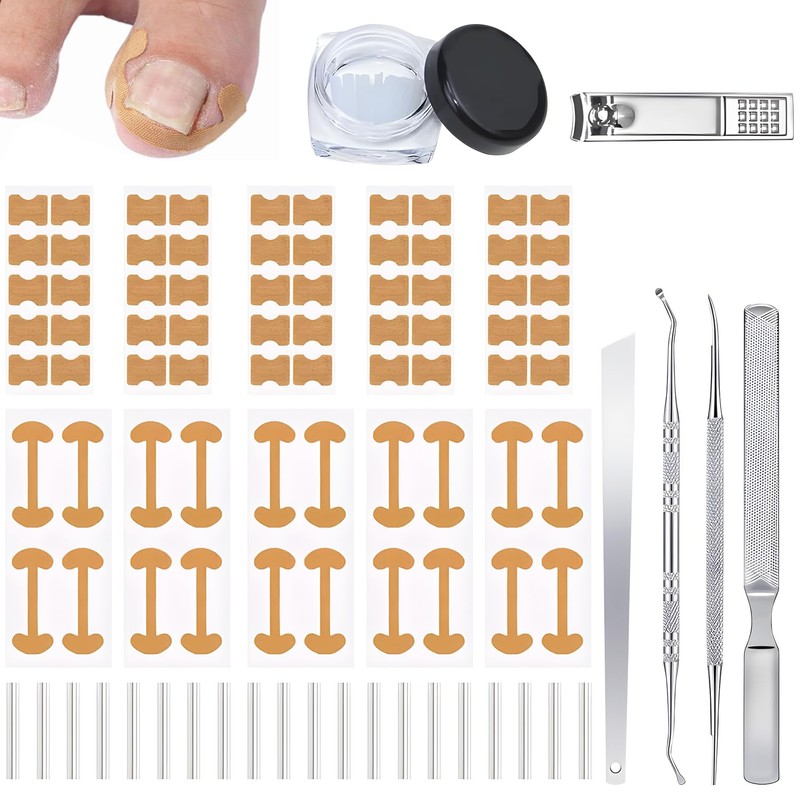 LUSCOR Kit Para Uñas Enterradas,Professional Ingrown Toenail Set,Pegatinas Para Uñas,