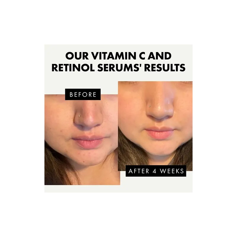Eclat Suero Retinol Para Ojos Y Suero Facial De Vitamina