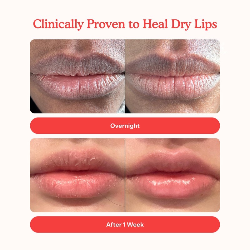 Tower 28 LipSoftie Hydrating Tinted Lip Treatment Balm, Moisturizing Lip