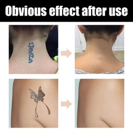 2 Colors Tatto Cover Up Makeup Waterproof,Smooth Tatto Cover,Invisible Tatt/o Concealer Set,Tatto/o Cover Up Concealer Cream for Spot Birthmarks Scars,Sweatproof Body Makeup Concealer Set