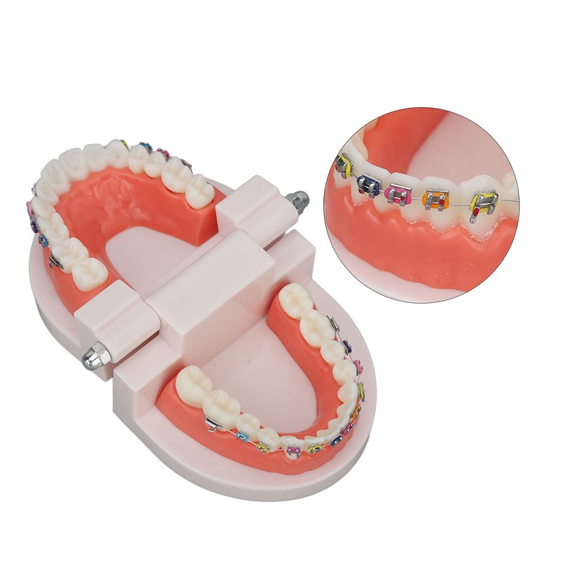 Dental Typodont Teeth Model with Orthodontic Metal Bracket for Dentist