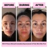 Set Mascarillas Bio Colágeno Hidratantes Intensas