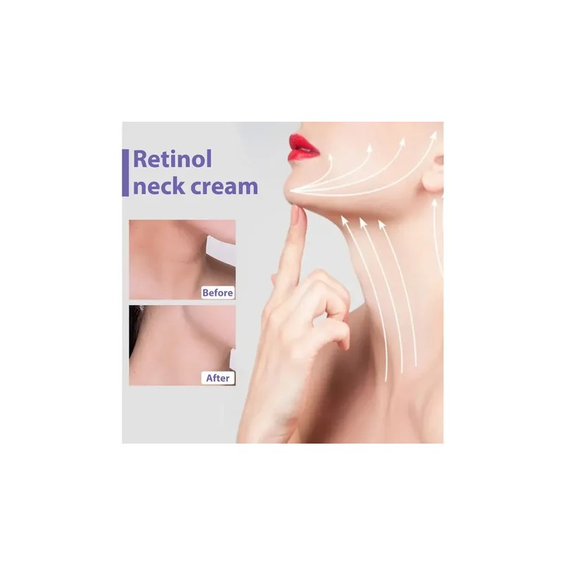 D P Crema De Cuello Eelhoe Retinol Para Arrugas Y