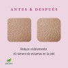 Crema Tepezcohuite Reparación Profunda Anti-acne Premium 500 Todo Tipo De