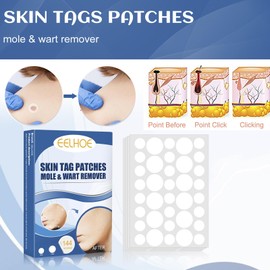AYNKH 264 Patch for Suction Plate, Invisible Hydrocolloid, Skin Treatment, Face Fast Pox Patch, Titanium Pox Needle Blackening, Multiple Sizes