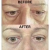 Instant Eye Bag Puffiness And Wrinkle Remover Cream For Women