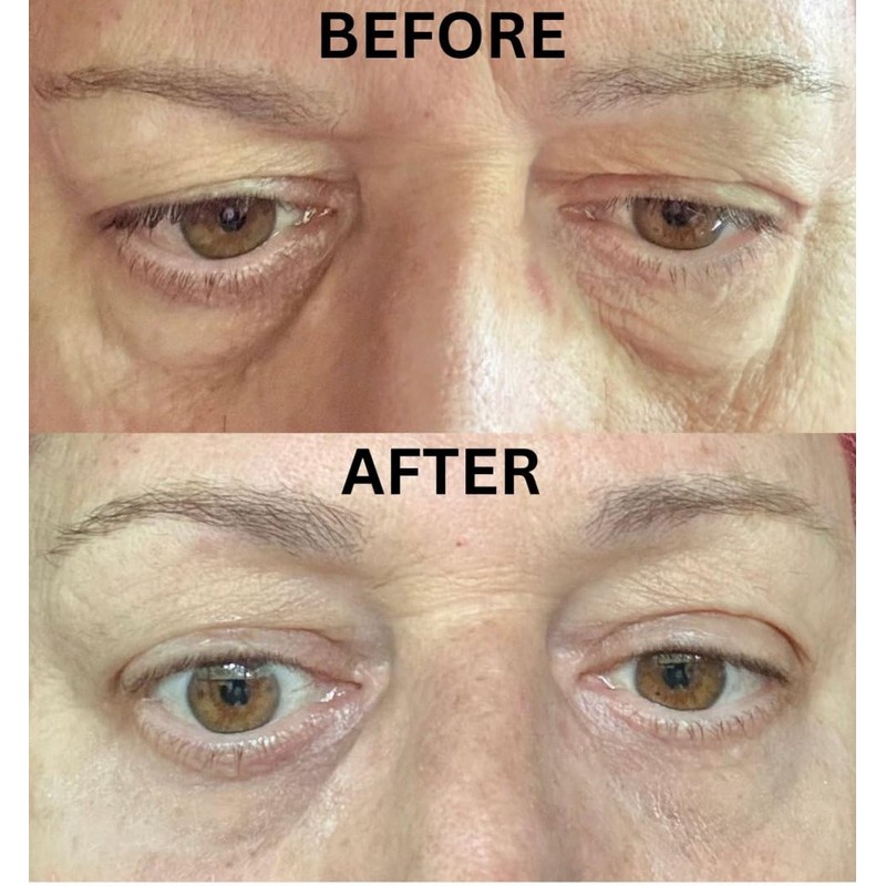 Instant Eye Bag Puffiness And Wrinkle Remover Cream For Women