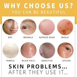 Turmeric Soap Bar, Handmade Soap Bar Pure Soap Bar, with Camellia Oil, Shea Butter, Turmeric, Olive Oil, for Face & Body, Skincare Face Care, for Deep Cleansing & Smooth Skin, 100g