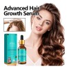 Azs Esencia Avanzada Crecimiento Capilar 30ml .