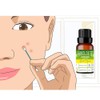 Aceite Esencial De Árbol De Té Antimicotico 100% Natural
