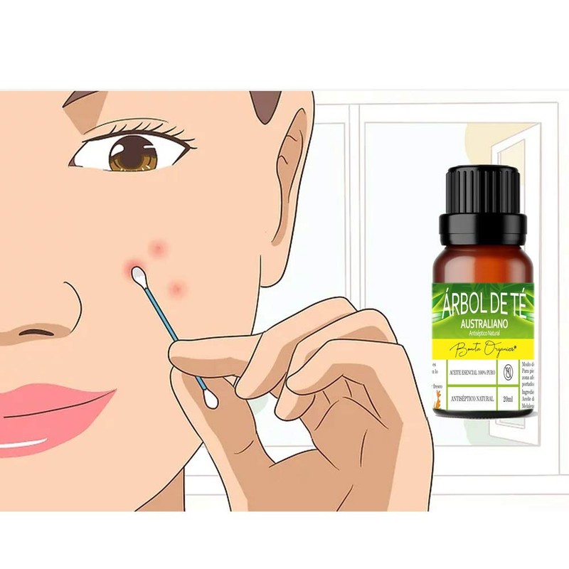 Aceite Esencial De Árbol De Té Antimicotico 100% Natural